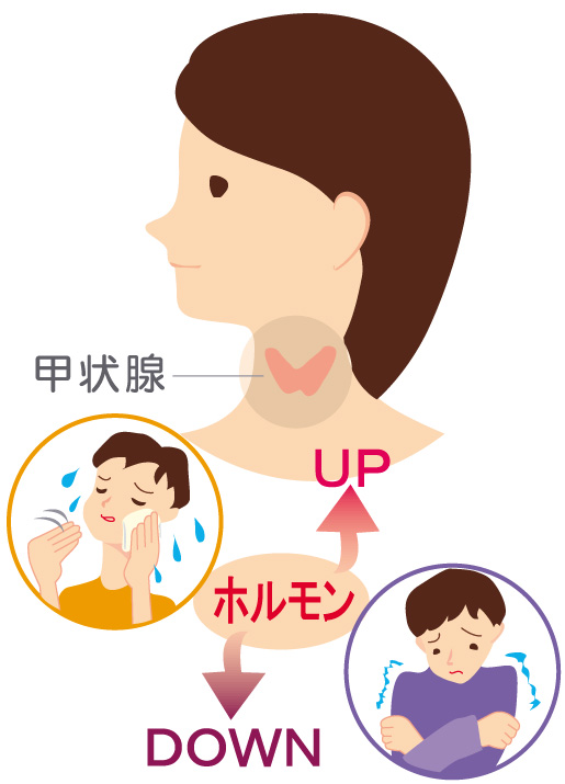 甲状腺疾患とは