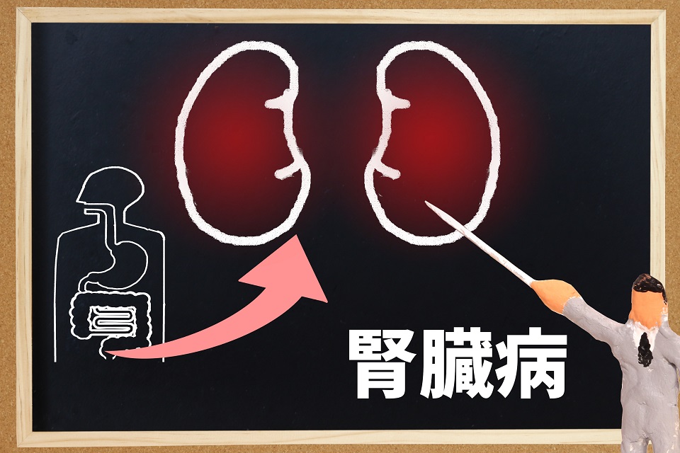 高尿酸血症と腎臓の関係